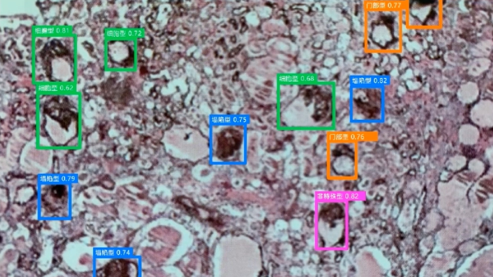 AI醫(yī)療領(lǐng)域應(yīng)用